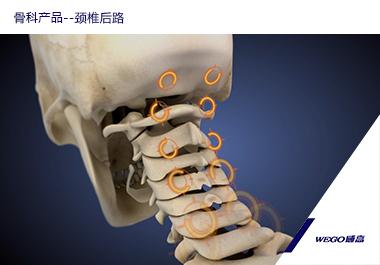 骨科產品--頸椎后路